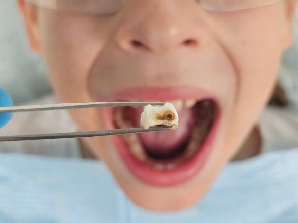 Best Weekend Emergency Dentist in Glasgow, KY